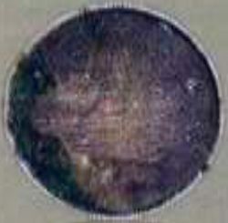 Providencia reverse
